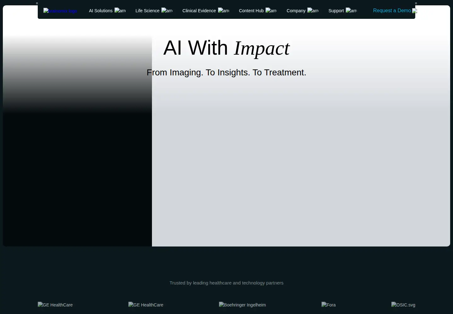 Screenshot of brainomix.com
