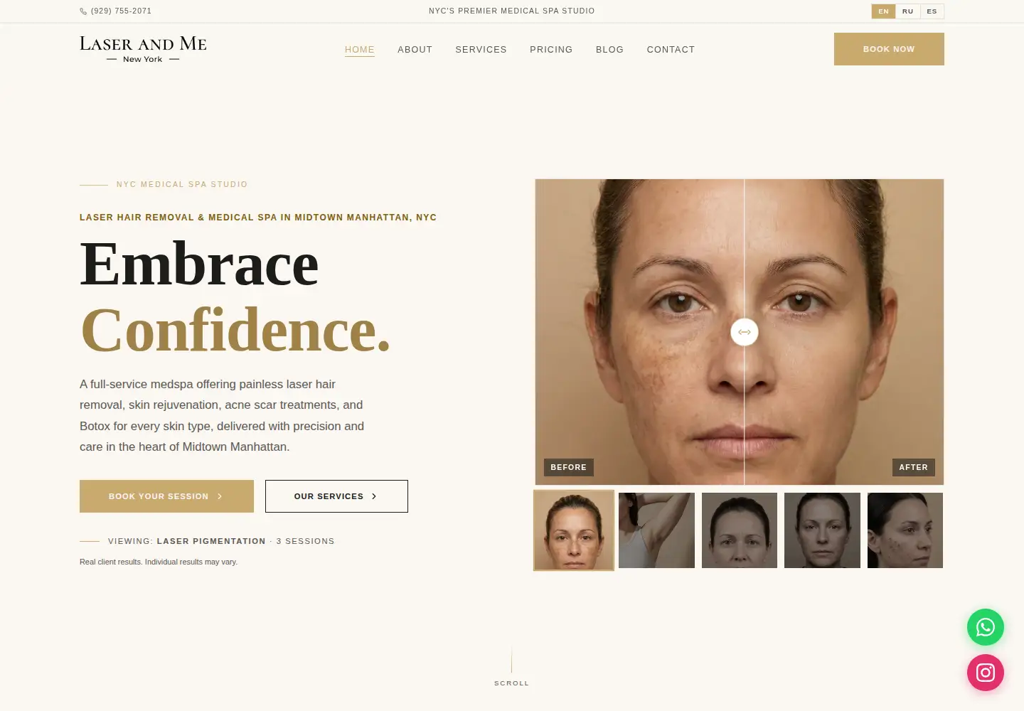 Screenshot of laserandme.com