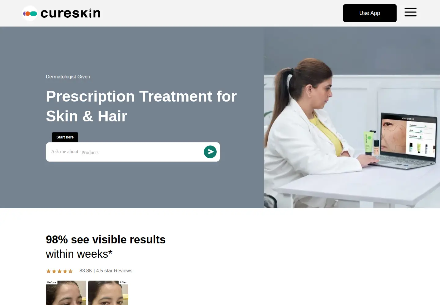 Screenshot of cureskin.com