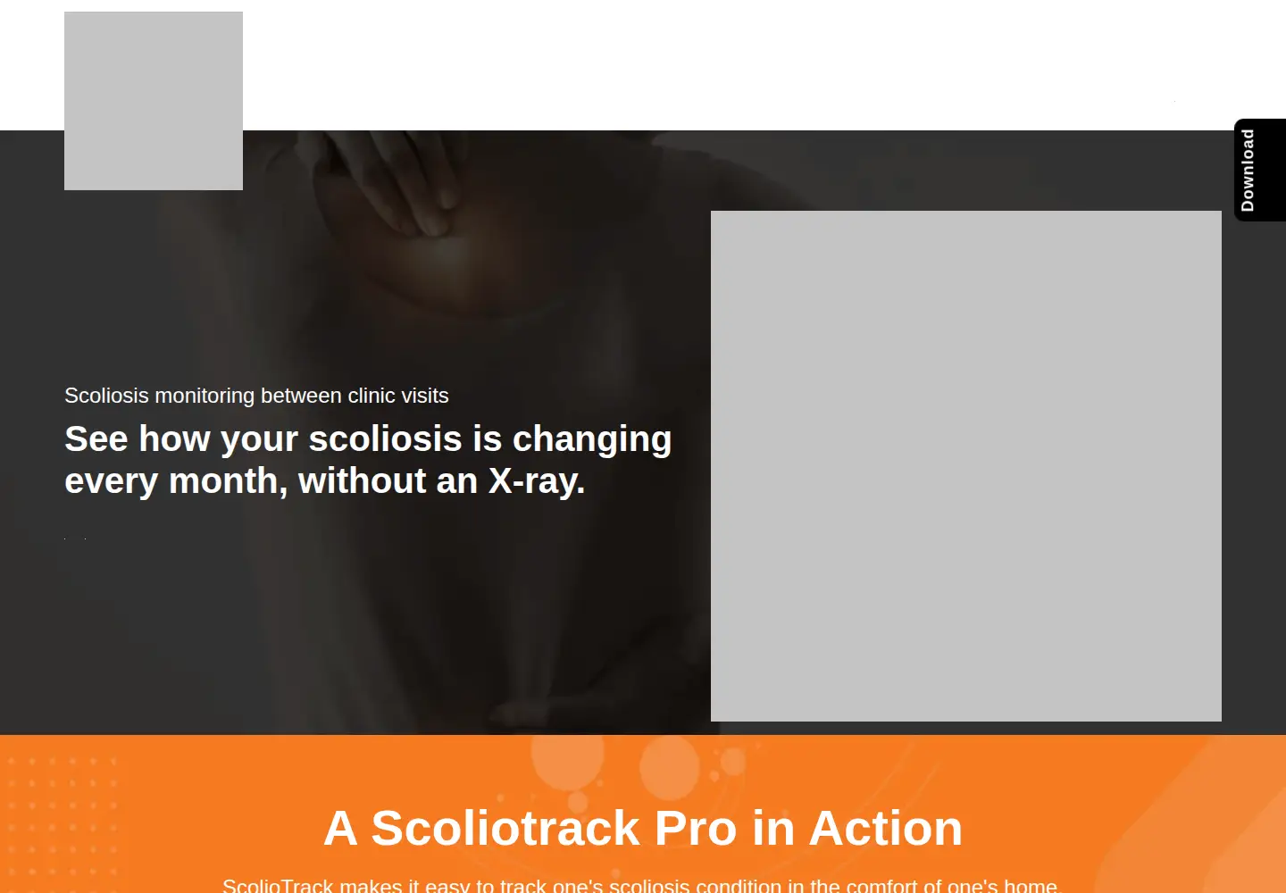 Screenshot of scoliotrack.com